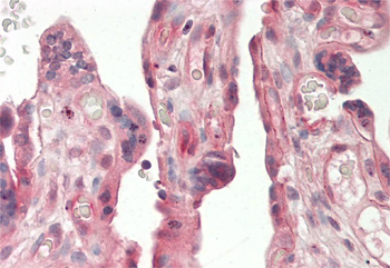 ADIPOR2 Rabbit Polyclonal Antibody