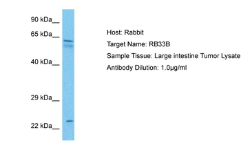 RAB33B Rabbit Polyclonal Antibody
