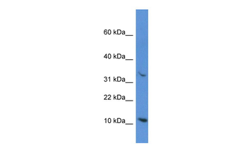 CYCS Rabbit Polyclonal Antibody