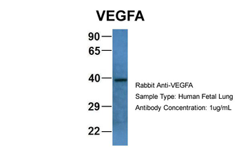 VEGFA Rabbit Polyclonal Antibody
