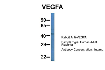 VEGFA Rabbit Polyclonal Antibody