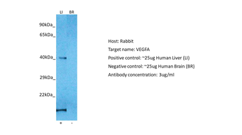VEGFA Rabbit Polyclonal Antibody