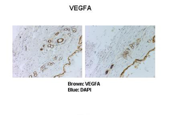 VEGFA Rabbit Polyclonal Antibody