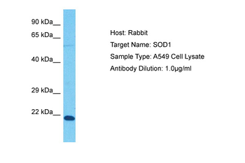 SOD1 Rabbit Polyclonal Antibody