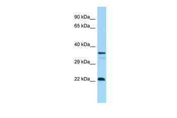 CD83 Rabbit Polyclonal Antibody
