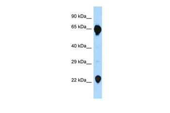 RAG2 Rabbit Polyclonal Antibody