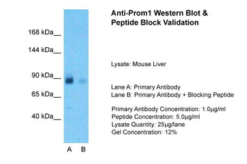 Prom1 Rabbit Polyclonal Antibody