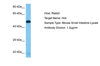 HCK Rabbit Polyclonal Antibody