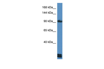 DSG3 Rabbit Polyclonal Antibody