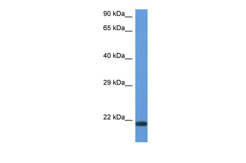 CD70 Rabbit Polyclonal Antibody