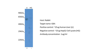 GBA Rabbit Polyclonal Antibody
