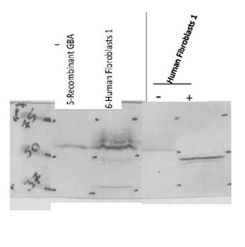 GBA Rabbit Polyclonal Antibody