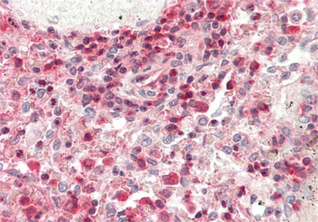 TNFAIP3 Rabbit Polyclonal Antibody