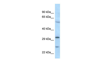 MAD2L1BP Rabbit Polyclonal Antibody