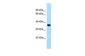 CYSLTR1 Rabbit Polyclonal Antibody