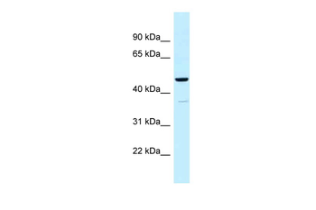 UQCRC1 Rabbit Polyclonal Antibody