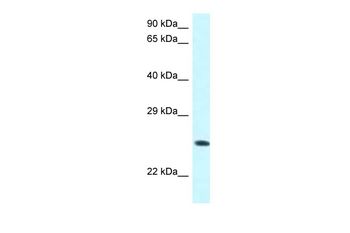 WWOX Rabbit Polyclonal Antibody