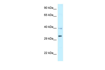 TNFRSF14 Rabbit Polyclonal Antibody