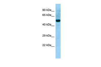 ABI2 Rabbit Polyclonal Antibody