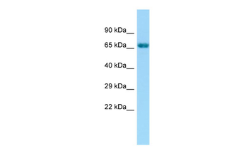 GRK6 Rabbit Polyclonal Antibody