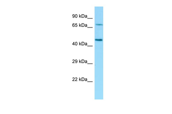 GLB1 Rabbit Polyclonal Antibody