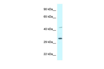 BST1 Rabbit Polyclonal Antibody
