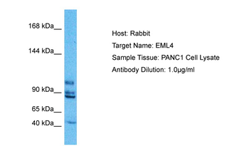 EML4 Rabbit Polyclonal Antibody