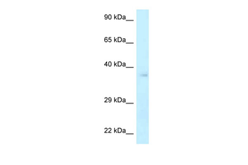 NHEJ1 Rabbit Polyclonal Antibody