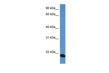 COMMD1 Rabbit Polyclonal Antibody