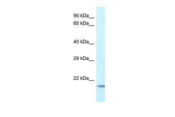 UBE2V1 Rabbit Polyclonal Antibody