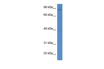 VAC14 Rabbit Polyclonal Antibody