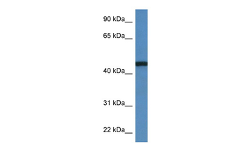 RRS1 Rabbit Polyclonal Antibody