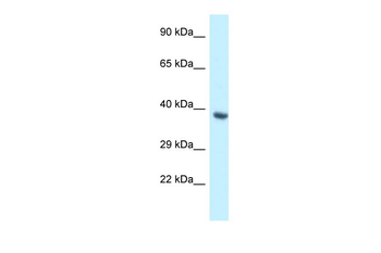 BCL2L12 Rabbit Polyclonal Antibody