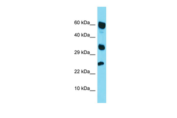 RARRES1 Rabbit Polyclonal Antibody