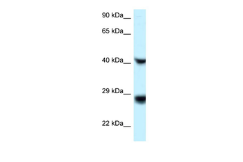 RIT1 Rabbit Polyclonal Antibody