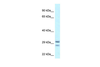 RIT1 Rabbit Polyclonal Antibody