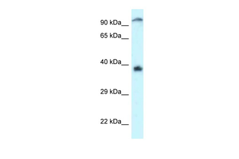 DOK7 Rabbit Polyclonal Antibody