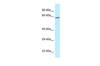 CCT3 Rabbit Polyclonal Antibody
