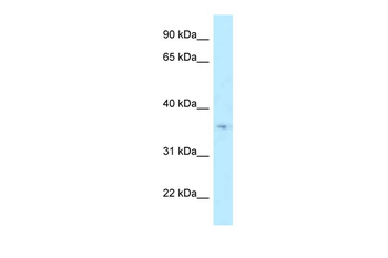 HSD17B7 Rabbit Polyclonal Antibody