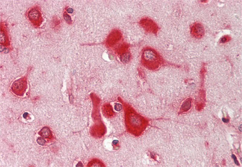 SRPK2 Rabbit Polyclonal Antibody