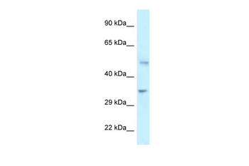 PFKFB1 Rabbit Polyclonal Antibody