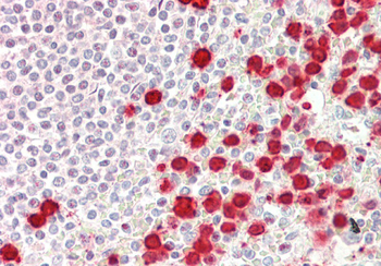 TOM1L1 Rabbit Polyclonal Antibody