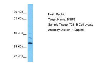 BNIP2 Rabbit Polyclonal Antibody