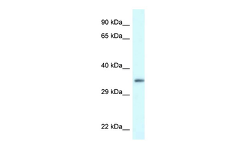 PDLIM1 Rabbit Polyclonal Antibody