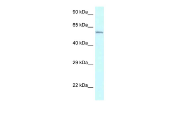 CYP2U1 Rabbit Polyclonal Antibody