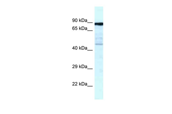 CKAP2 Rabbit Polyclonal Antibody