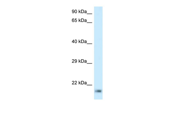 RPL23A Rabbit Polyclonal Antibody
