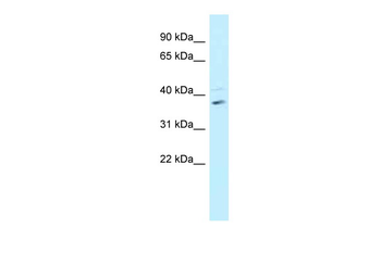 BRCC3 Rabbit Polyclonal Antibody