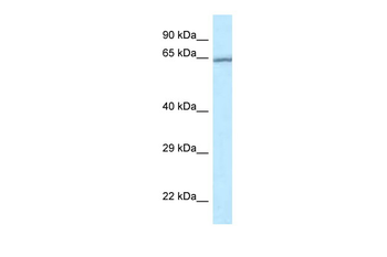 RASGRP4 Rabbit Polyclonal Antibody
