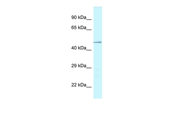 CHI3L2 Rabbit Polyclonal Antibody